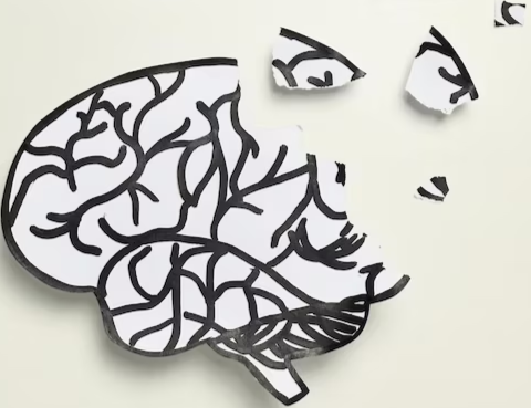 Alzheimer